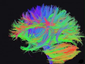 Alzheimer's Study Delves into Degraded Connections in the Brain